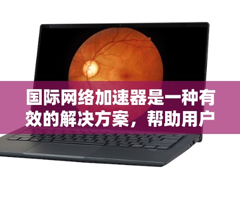 国际网络加速器是一种有效的解决方案，帮助用户快速访问国外网站，缓解延迟问题。以下是对国际网络加速器的详细分析和使用建议